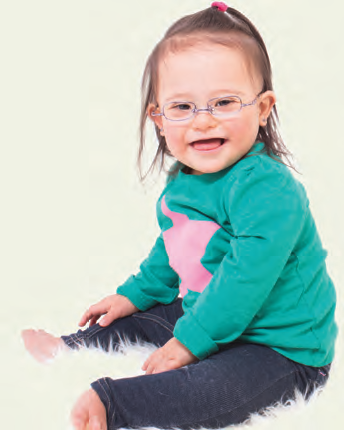 Should bifocal spectacles be prescribed to paediatric patients with Down’s Syndrome as routine clinical management?